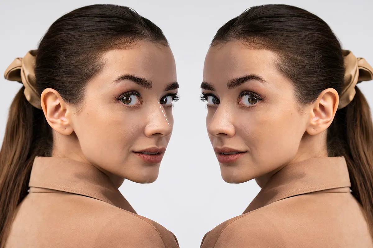 Tunceli Burun Estetiği